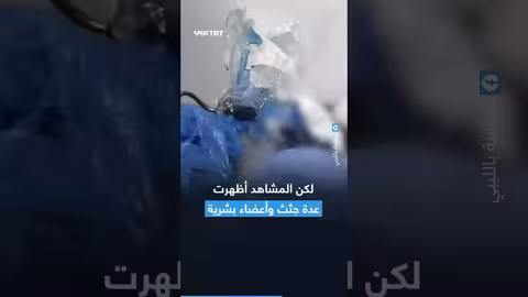 فضيحة مصحة بطرابلس: جثث أطفال وأطراف مجمدة