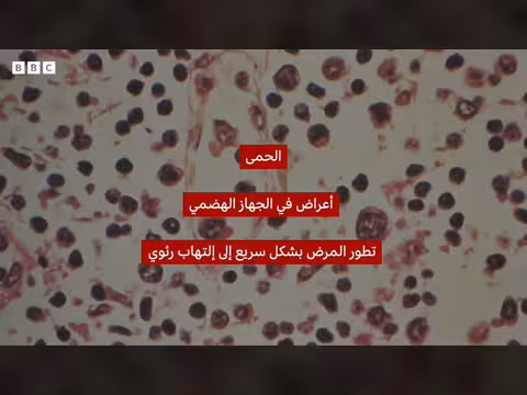 وفاة ثلاثة أشخاص بعد تفشي فيروس هانتا على سفينة سياحية