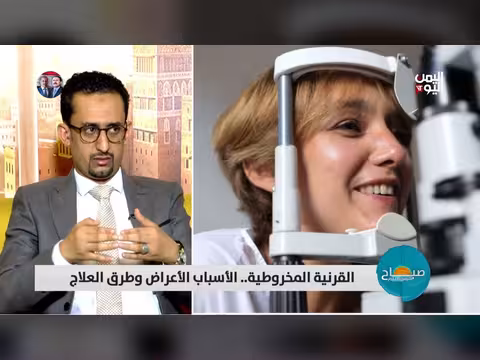 القرنية المخروطية أكثر أمراض العين شيوعاً