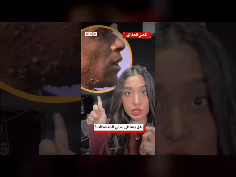 تحقيق في ادعاء ات تعاطي مبابي المنشطات