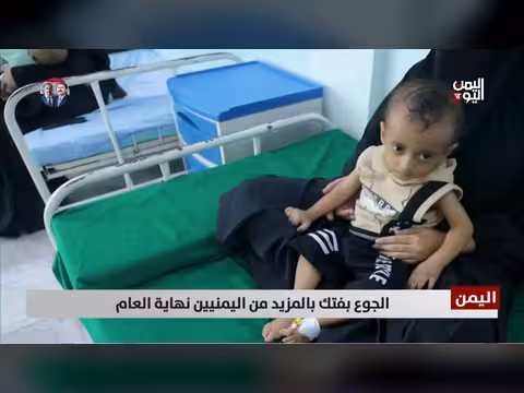 الجوع يتفشى في اليمن مع اقتراب نهاية العام