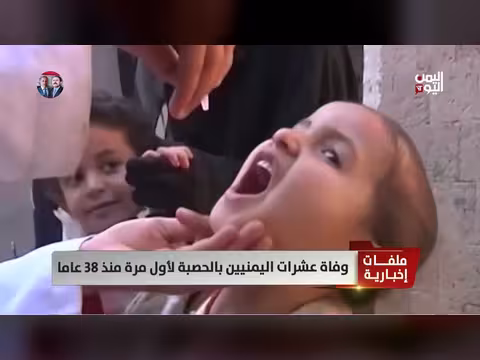 وفاة dozens of Yemenis from measles for the first time in 38 years