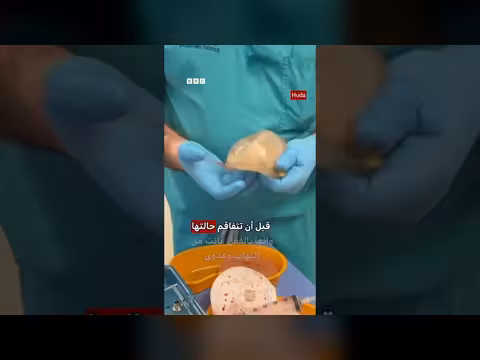 هدى قطان تحذر من مخاطر عدم متابعة الطبيب