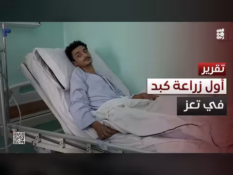 تعز تسجل نجاح أول عملية زراعة الكبد