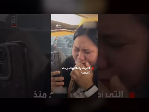 نجاح عملية فصل التوأم الفلبيني الملتصق في الرياض