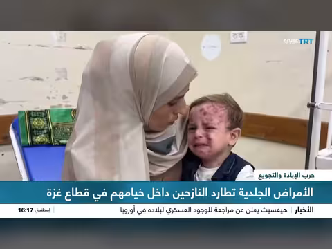 تدهور الأوضاع الصحية في غزة بسبب نقص الخدمات