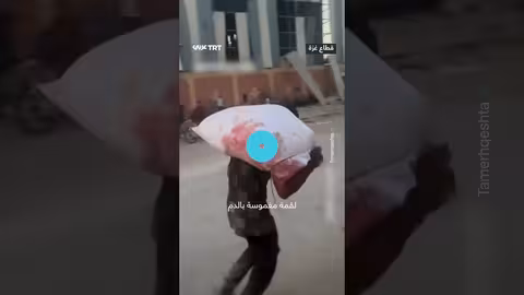 شاب مصاب يحمل طحين ملطخاً بالدماء وسط مجازر إسرائيلية