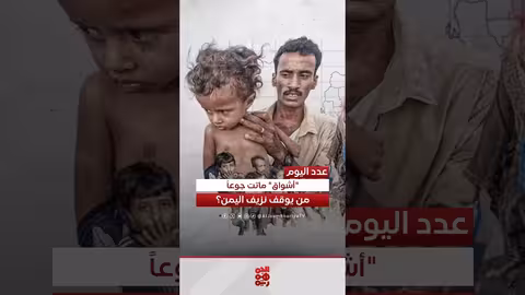 وفاة طفلة يمنية جوعاً في مخيم للنازحين بحجة
