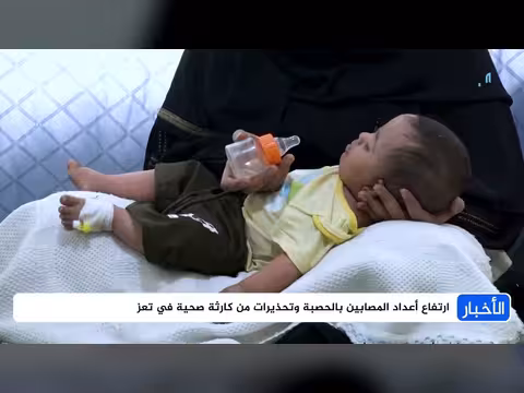 ارتفاع حالات الحصبة وتحذيرات من كارثة صحية في تعز