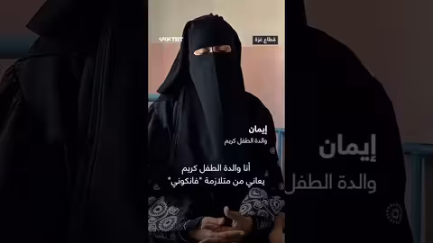 معاناة طفل يمني من متلازمة نادرة وسوء تغذية حاد