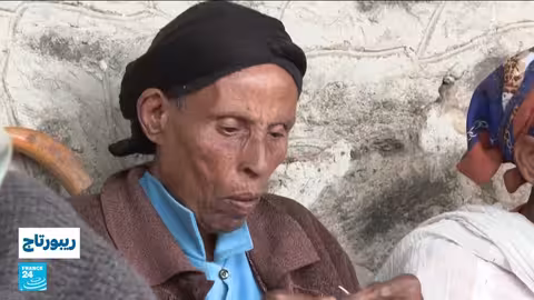 الجذام في إثيوبيا: تحديات الرعاية الصحية وتأثير المساعدات