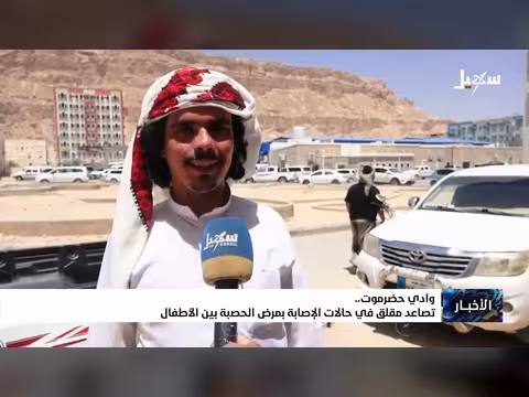 تصاعد حالات الإصابة بمرض الحصبة في حضرموت