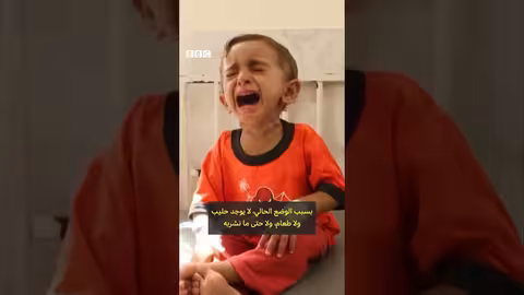 أطفال غزة يواجهون خطر الموت بسبب سوء التغذية
