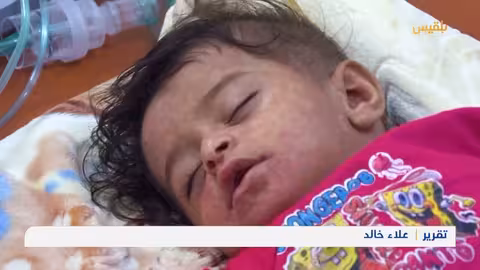 تعز.. تسجيل مئات المصابين بالأمراض الموسمية وسط ضعف إمكانات المنشآت الطبية تقرير: علاء خالد