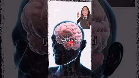 كيم كارداشيان تكشف إصابتها بتمدد الأوعية الدموية في الدماغ