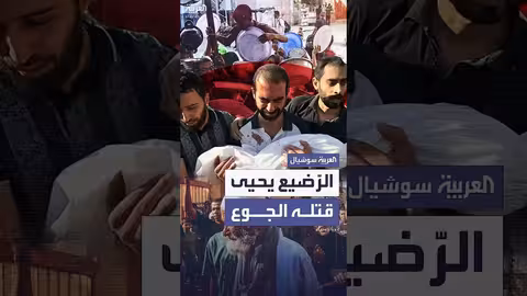 أزمة الجوع في غزة: وفيات أطفال وسوء تغذية حاد