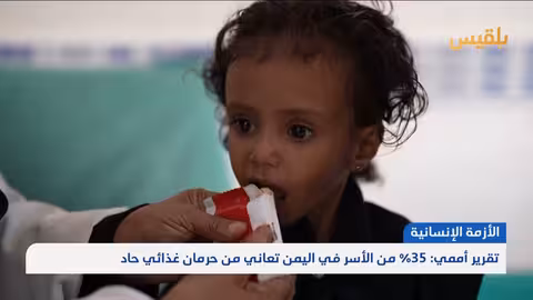 اليمن: تقرير أممي يكشف عن حرمان غذائي حاد لـ 35% من الأسر