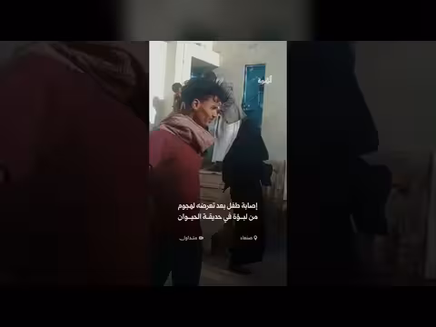 إصابة طفل بعد هجوم لبؤة في حديقة الحيوان بصنعاء