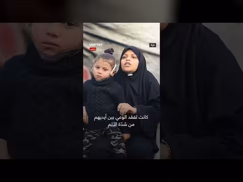 طفلة فلسطينية تتحدث عن معاناة تشويه وجهها