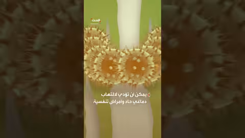 فيروسات خطيرة في الخفافيش الصينية: تحذير من خطر جديد