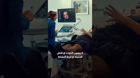 مراجعة جديدة تنفي ارتباط الباراسيتامول بالتوحد