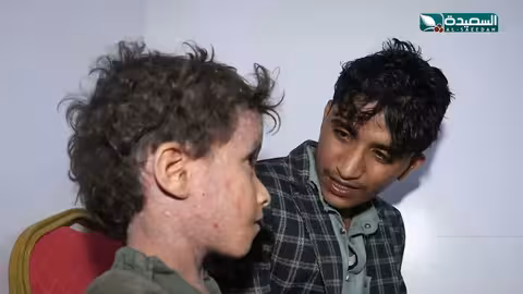 طفل يمني يعاني من مرض غامض يناشد للمساعدة