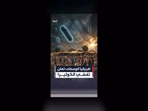أفريقيا الوسطى تعلن تفشي الكوليرا بعد 24 حالة وفاة