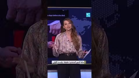 ظهور كدمة على يد ترامب يثير التساؤلات