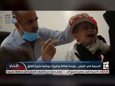 موجة الحصبة في اليمن تثير قلقاً بائيا