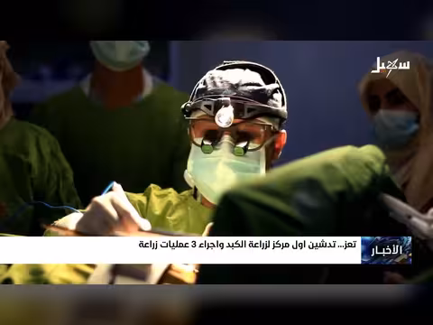 تدشين مركز زراعة الكبد في تعز
