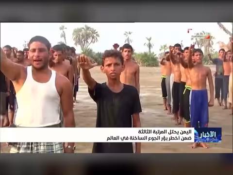 اليمن في المرتبة الثالثة من أخطر بؤر الجوع