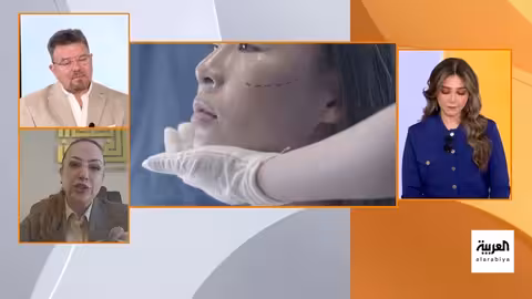 القبض على طبيبة تجميل مزيفة في مصر..ضحايا من المشاهير