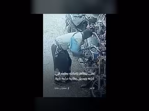 لص في تعز يتظاهر بكسر في ذراعه